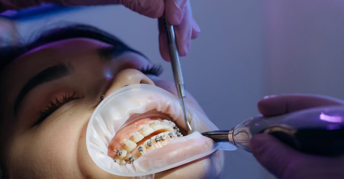 Dentist performing orthodontic procedure on patient with braces in a clinic setting.