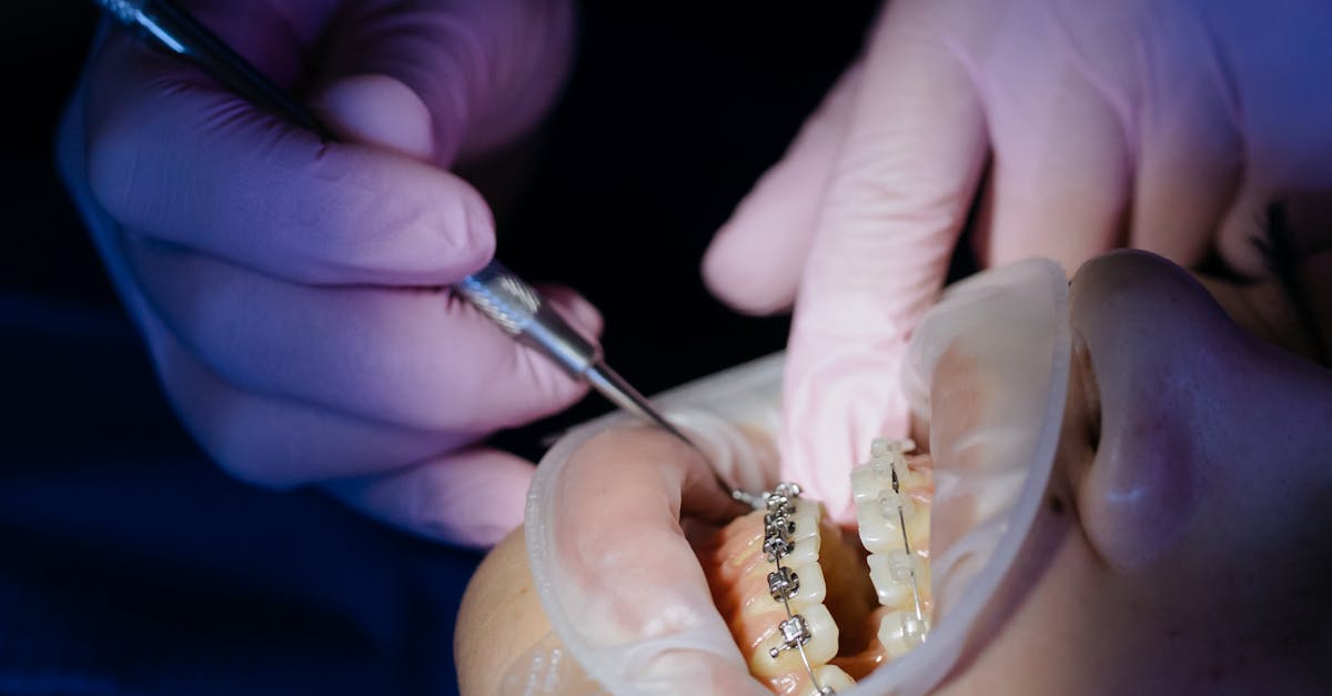 Dentist performing procedure on patient with braces, highlighting dental care.